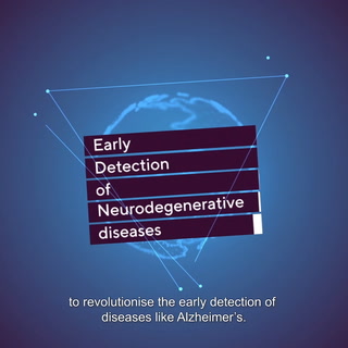 Alzheimer's Research UK